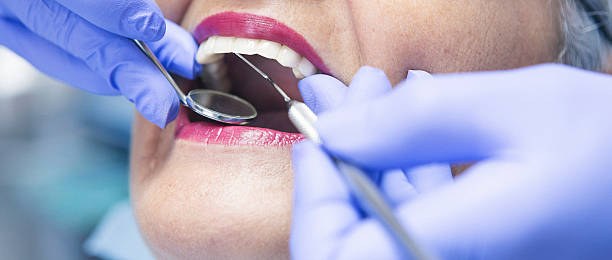 Best Emergency Dentist for Knocked-Out Tooth in New Rockford, ND