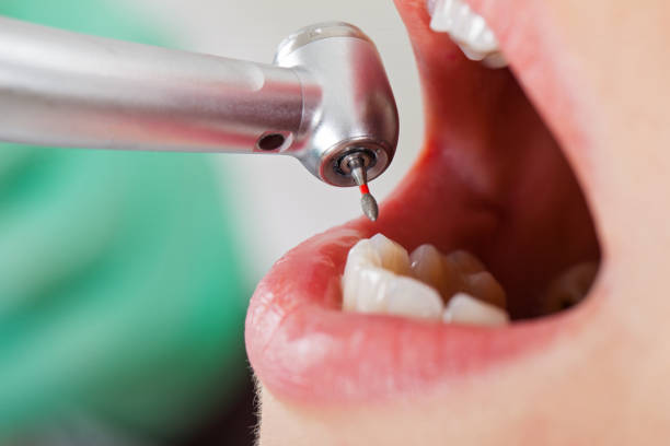 Best Pediatric Emergency Dentist in New Rockford, ND